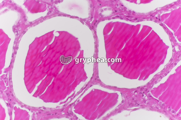 Thyroïde en hypo-activité x100 - gryphea.com